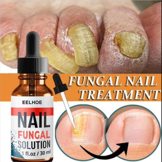 Hand and Foot Onychomycosis Care And Repair Liquid